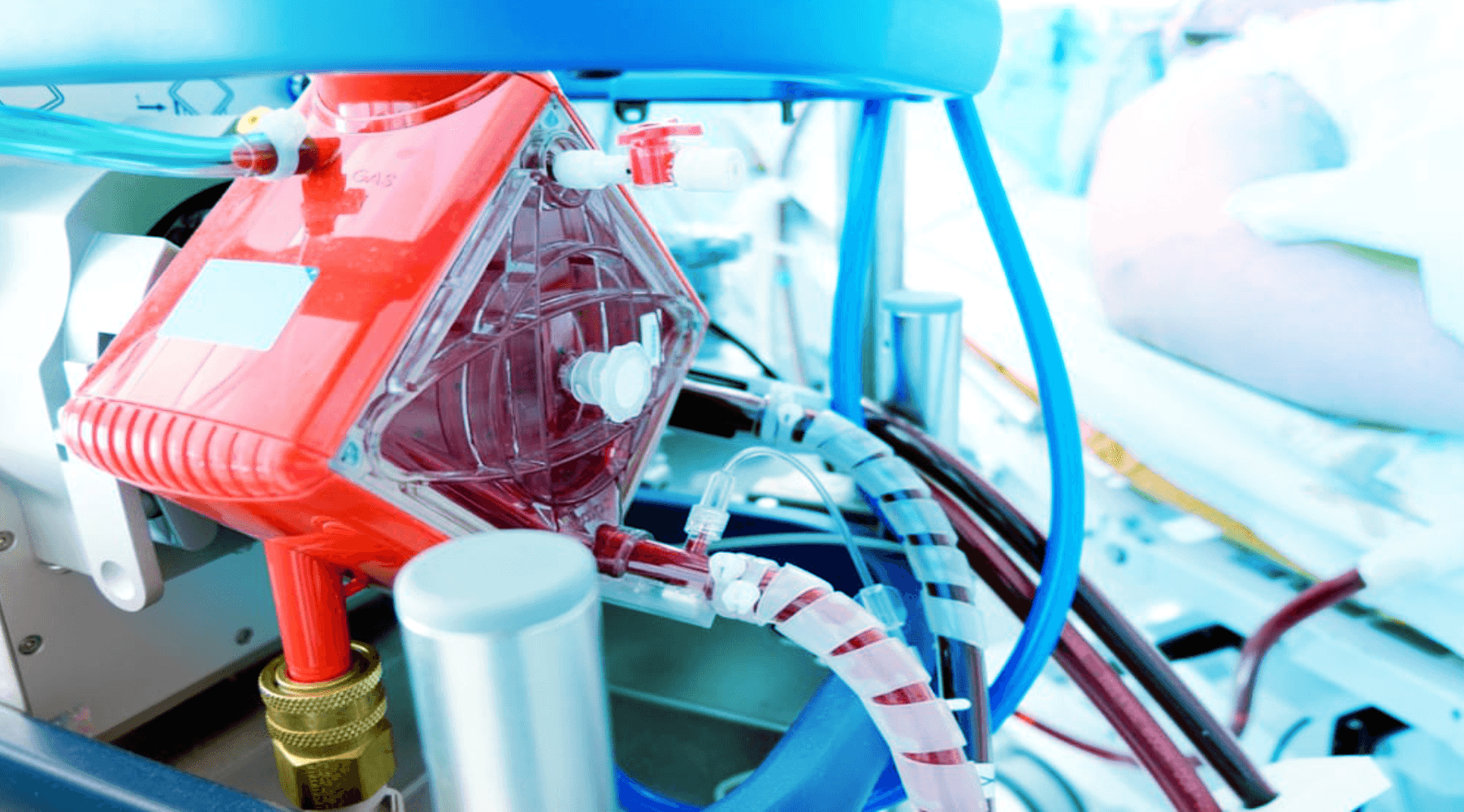 ECMO pode auxiliar pacientes graves de Covid-19
